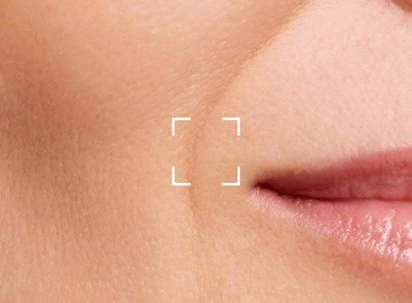 retinol for sensitive skin