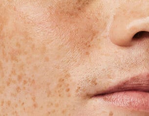 exfoliate face