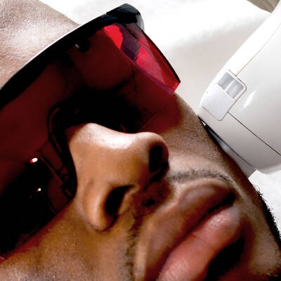 IPL Laser