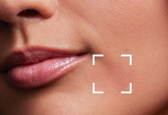 What Causes Fine Lines + Wrinkles Image