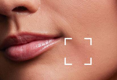 What Causes Fine Lines + Wrinkles Image