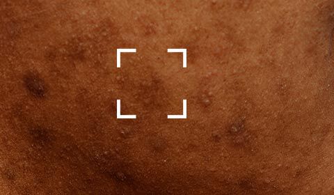 SkinCeuticals Skin Discolouration banner