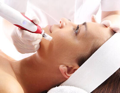 WHAT IS SKIN NEEDLING?