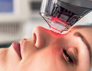 non-ablative laser for dark spots