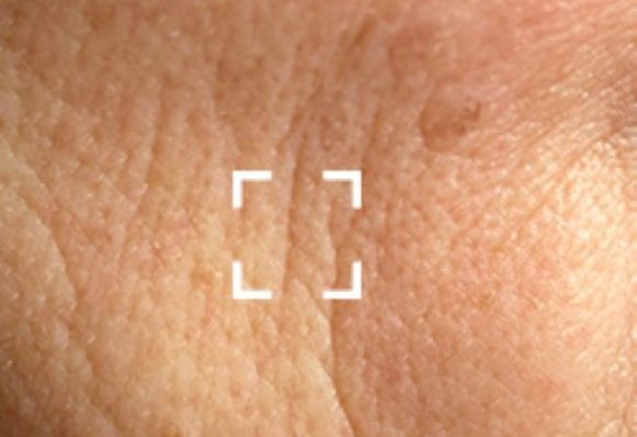 retinol for sensitive skin