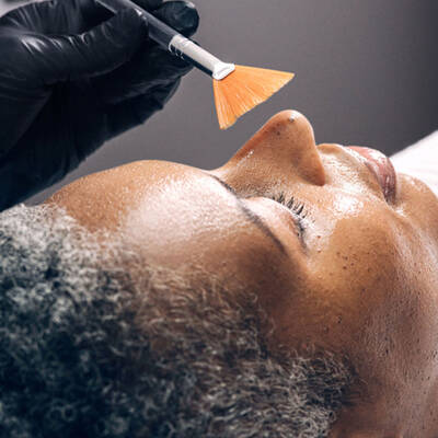 IPL Laser