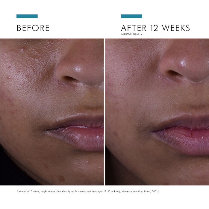 Silymarin CF vitamin C serum before and after comparison on brown skin model