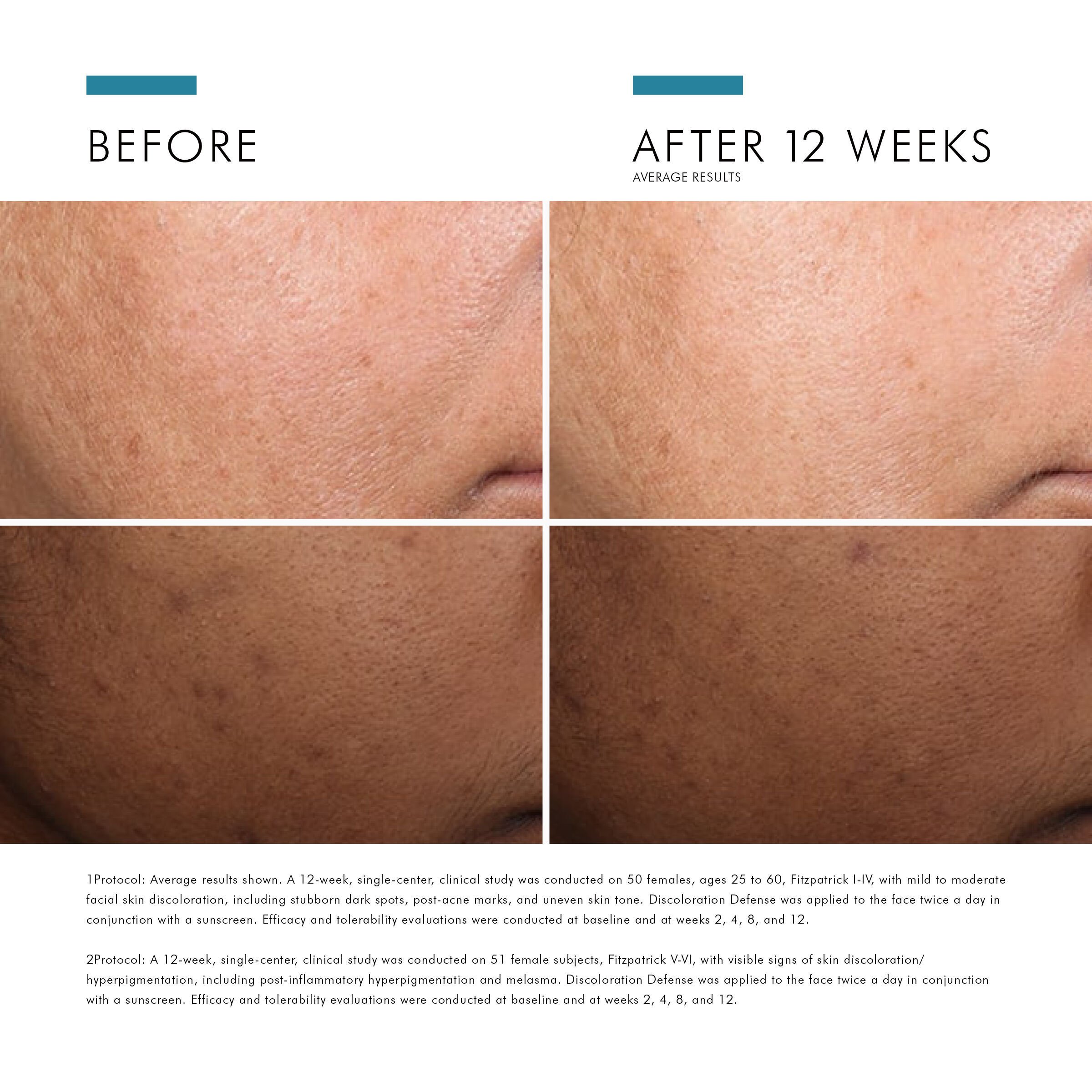 Before and after comparison showing visible improvement in skin tone and reduced dark spots after 12 weeks of use