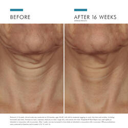 Tripeptide-R Retinol Neck Repair Cream