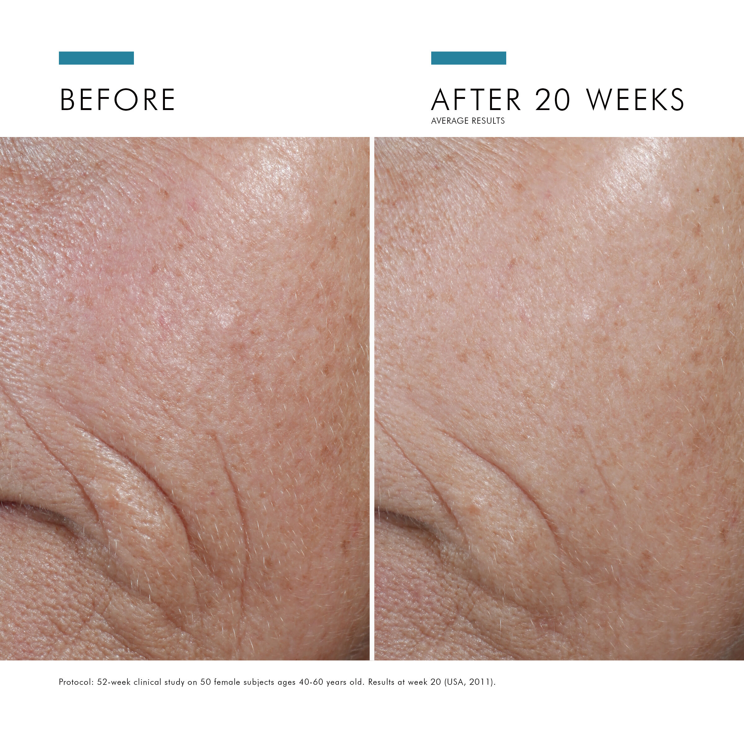SkinCeuticals CE Ferulic Vitamin C Serum Ferulic Acid