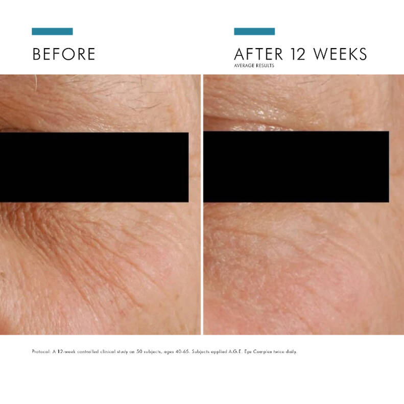 A.G.E. Complex Anti Ageing Eye Cream SkinCeuticals Australia