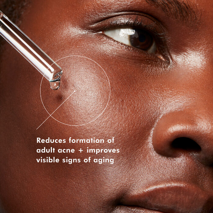 Applying Skinceuticals Blemish + Age Defense Serum on face with text  ‘Reduces formation of adult blemishes + improves visible signs of ageing’