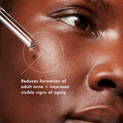 Applying Skinceuticals Blemish + Age Defense Serum on face with text  ‘Reduces formation of adult blemishes + improves visible signs of ageing’