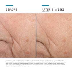 Triple Lipid Restore 242 Anti-Ageing Moisturiser