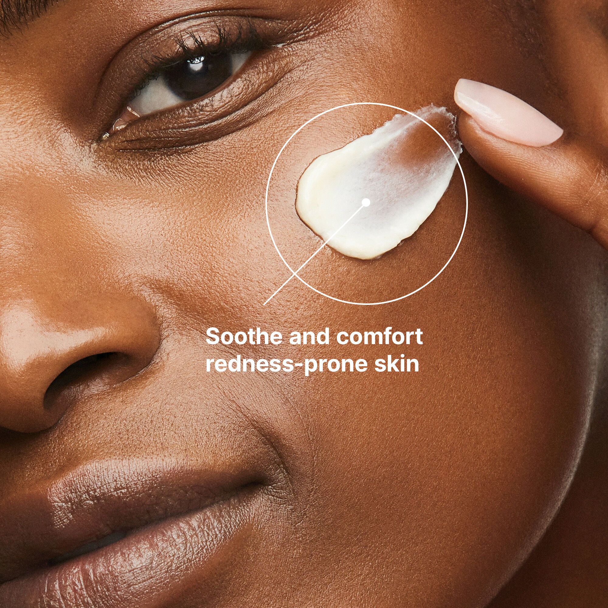 Redness Neutralizer Cream