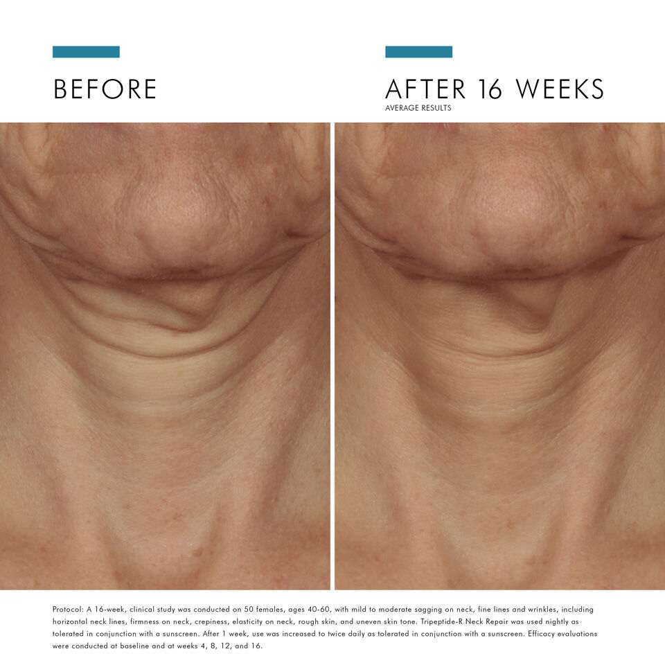 Tripeptide R Retinol Neck Repair Cream
