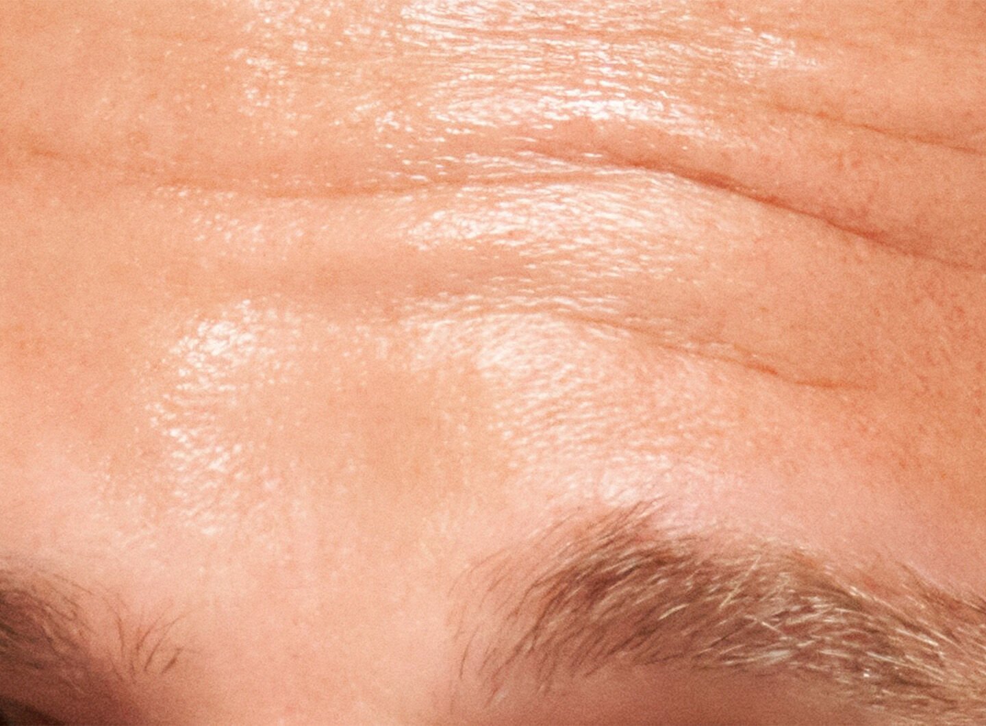 Wrinkles on Face: Causes, Types & Effective Treatment Options in malaysia